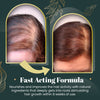 Laden Sie das Bild in den Galerie-Viewer, HairLive™ - Centella Scrub für sofortigen Haarwuchs | 1+1 GRATIS!