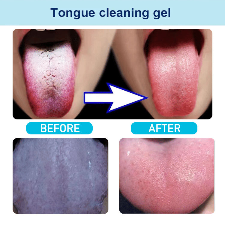 TongueClean™ - Zungenreiniger | 1+1 GRATIS!