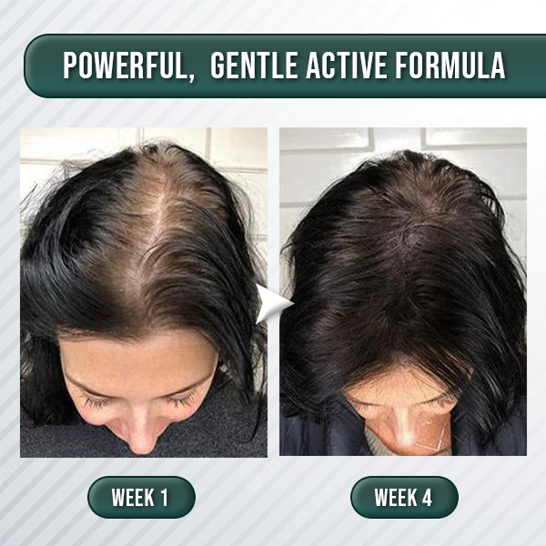 HairLive™ - Centella Scrub für sofortigen Haarwuchs | 1+1 GRATIS!
